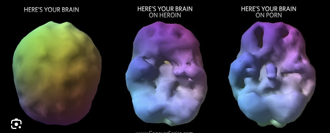 Brain comparison